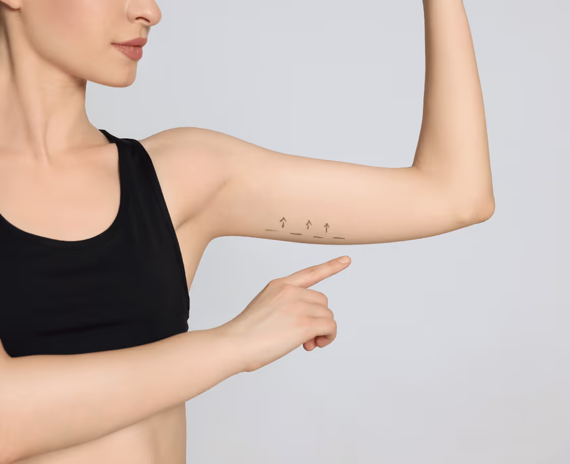 Expected results and benefits of arm lift surgery