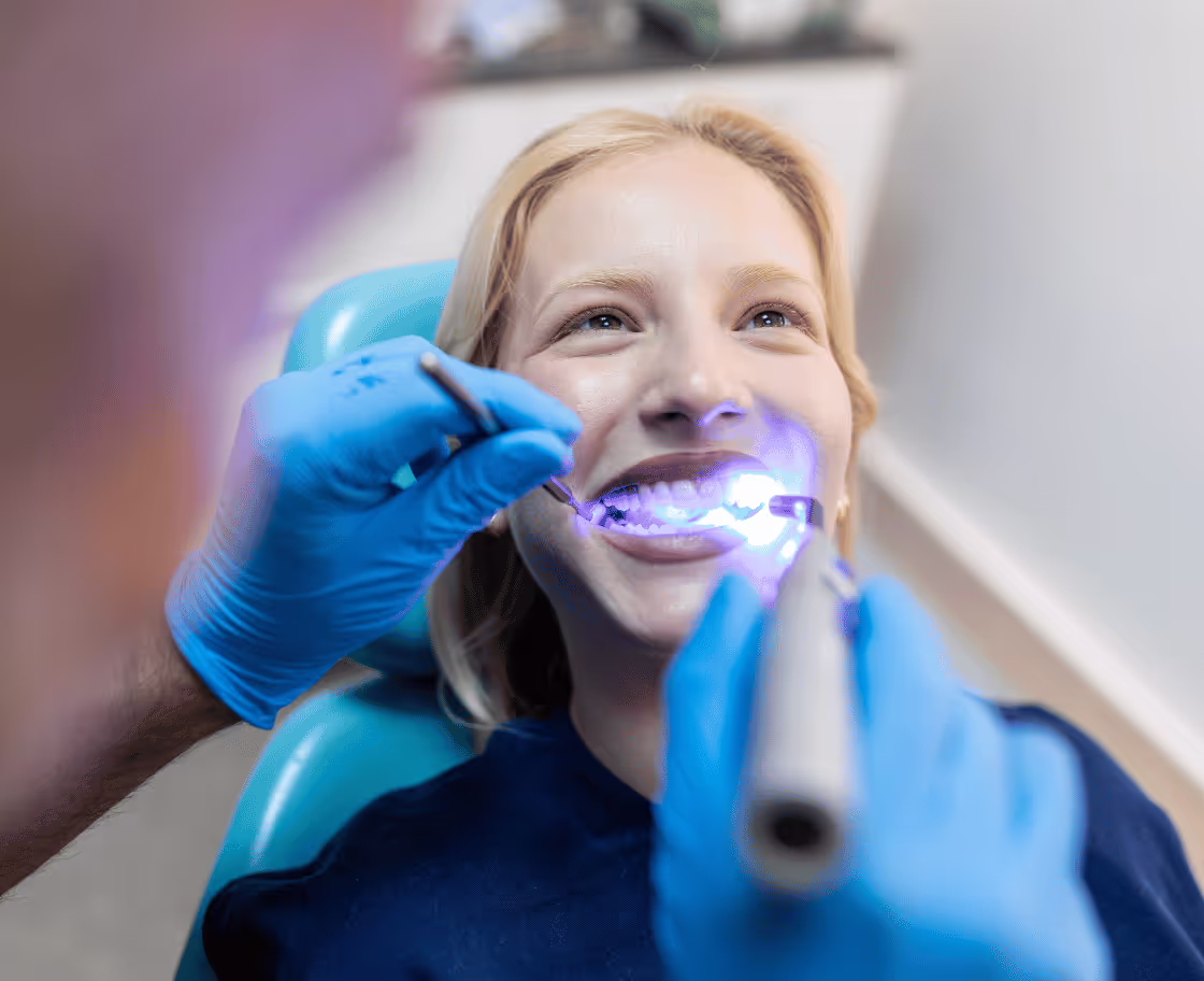 Expected Results & Benefits of Tooth Whitening