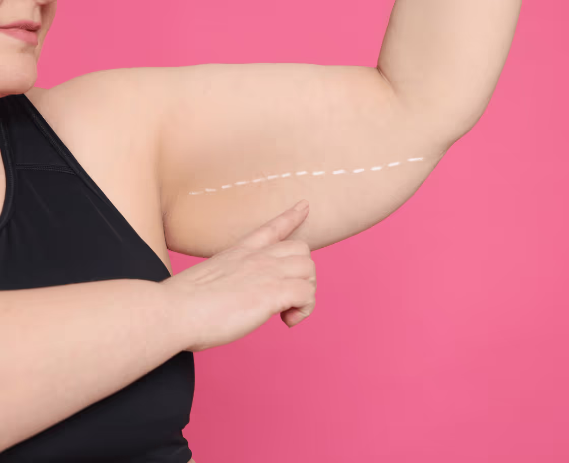 Wie funktioniert eine Armstraffung?