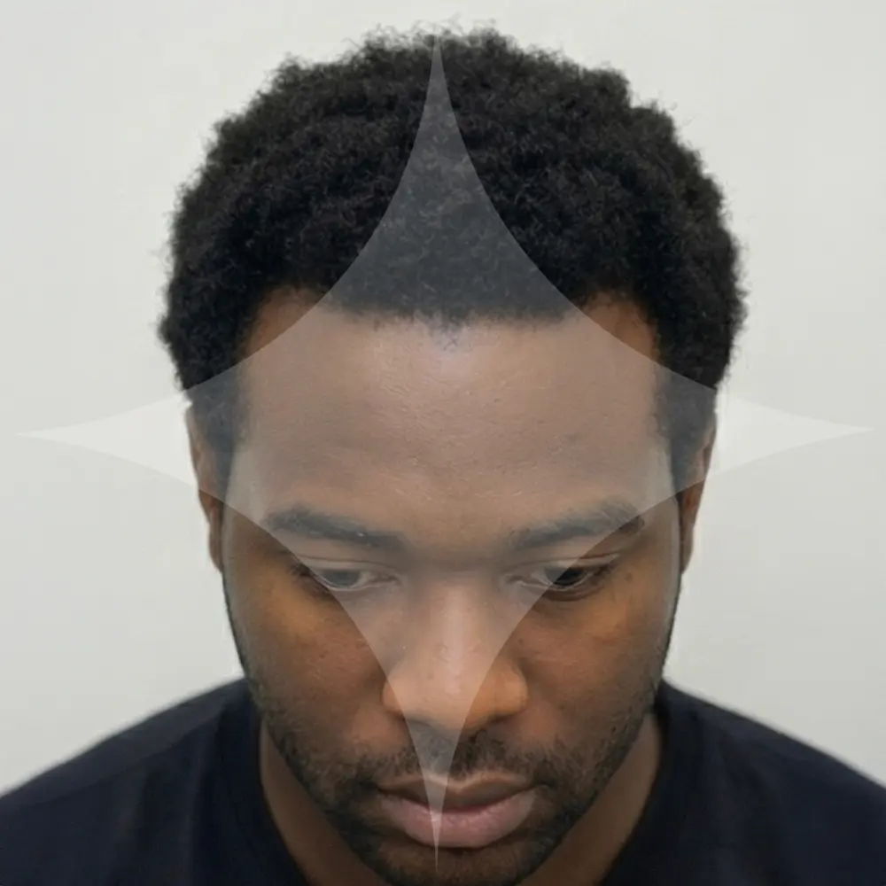 Henry (Fransa 🇫🇷)