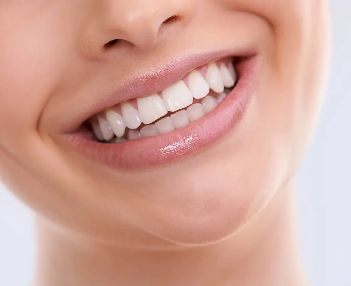 All on 4 Diş İmplantı Ameliyatı Nedir?