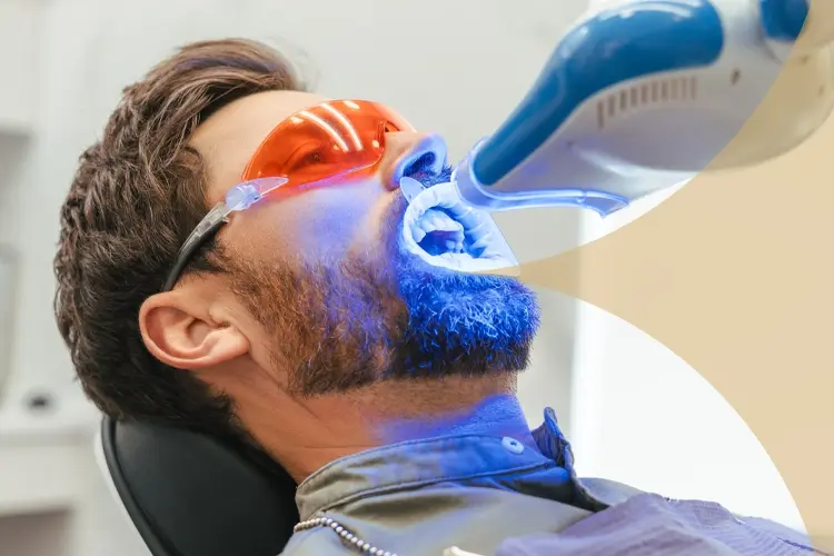 Tooth Whitening in Turkey