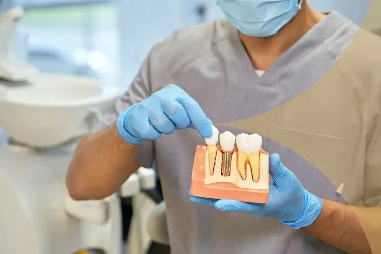 Dental Implants in Turkey