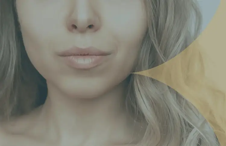 Buccal Fat Removal in Turkey