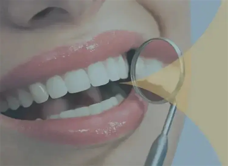 Estética Dental